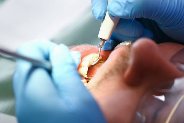Best Same-Day Emergency Dentist in Cave City, KY