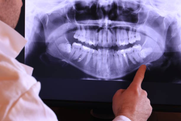 Best Emergency Treatment for Toothache in Cave City, KY
